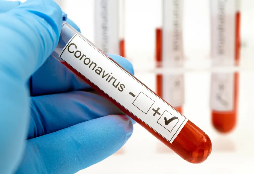 Argeș: 236 cazuri de coronavirus!