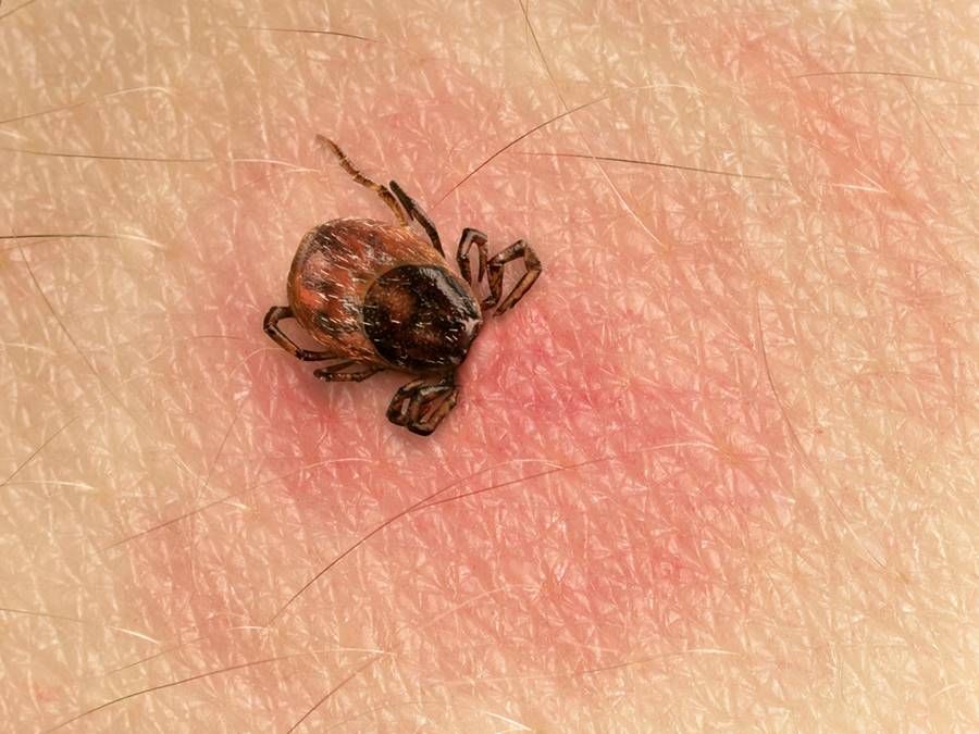 Atenție la căpușe! Șapte persoane, diagnosticate cu boala Lyme în Argeș