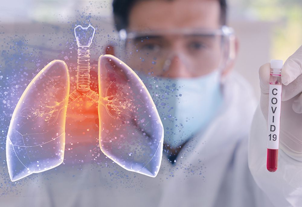 A crescut cu mult numărul de cazuri, de coronavirus!