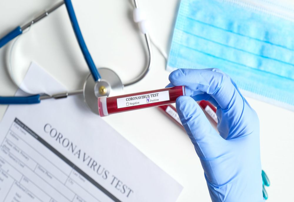 Bilanț coronavirus 24 mai: 230 de cazuri și 36 de decese