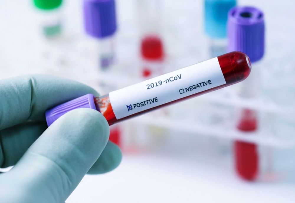 Bilanț coronavirus 18 octombrie: 10.141 cazuri noi de persoane infectate cu COVID în ultimele 24 de ore