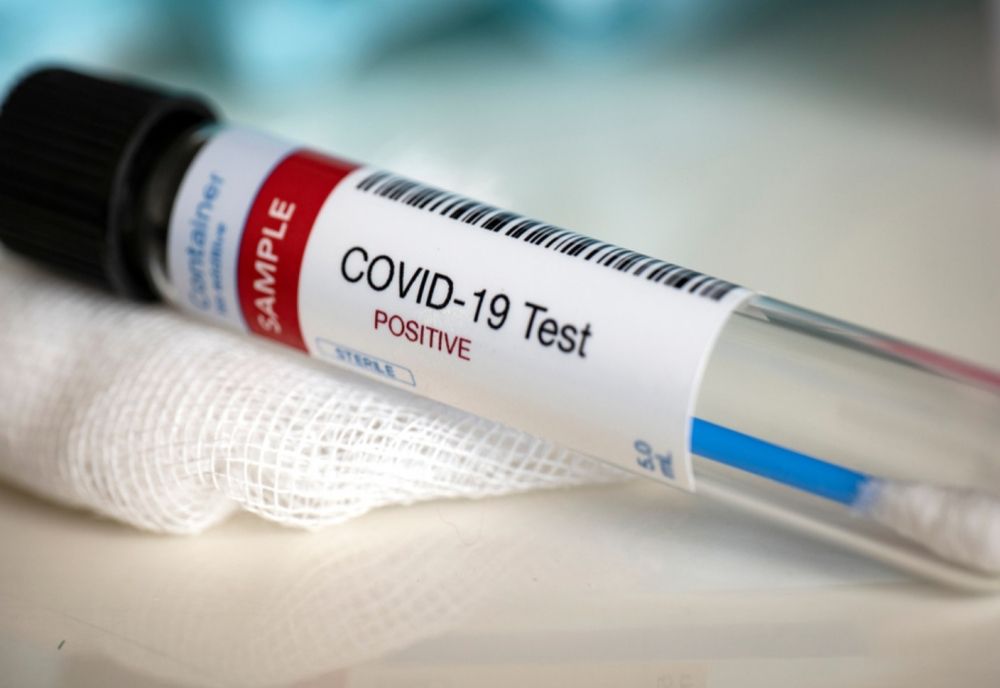 Bilanț coronavirus 25 noiembrie: 2.104 cazuri noi și 212 decese dintre care 35 anterioare