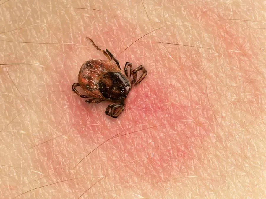 capuse boala lyme