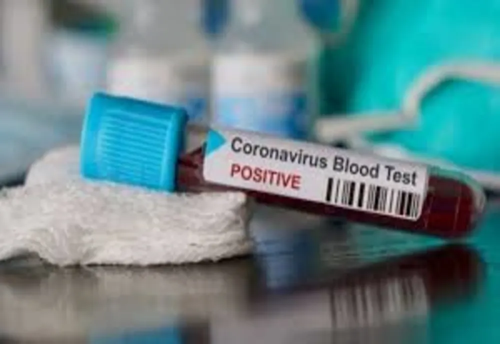 Organizația Mondială a Sănătății a declarat pandemie de coronavirus