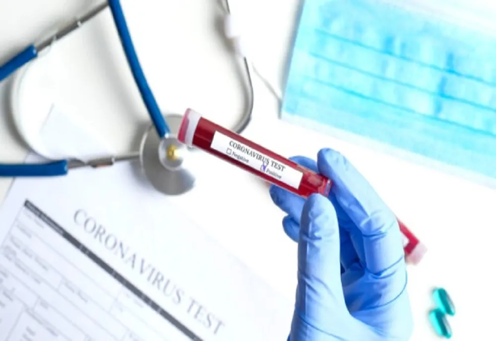 32 de decese provocate de coronavirus și 1365 de cazuri noi de infectare