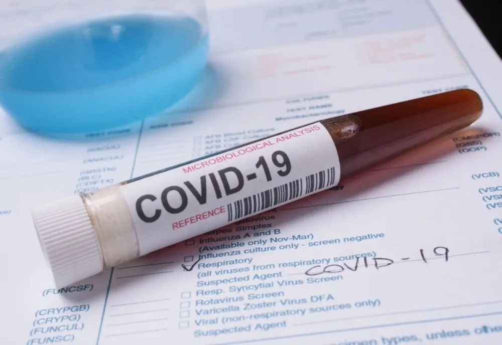 Bilanț coronavirus 31 august: 755 de cazuri noi, 43 de decese și 506 persoane internate la ATI