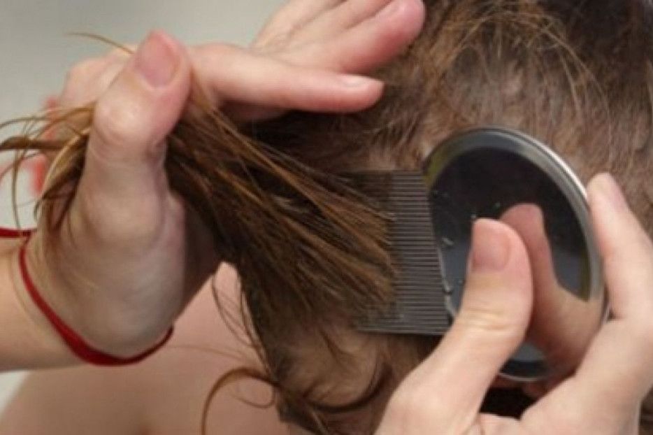 Zeci de elevi cu paduchi depistati in scolile din Arges