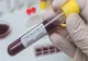 Comisarul șef al Poliţiei din Mioveni are coronavirus
