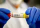 Au fost înregistrate 58 cazuri noi de persoane infectate cu SARS – CoV – 2