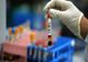  Un test de sânge ar putea detecta cancerul mamar cu cinci ani înaintea primelor simptome 