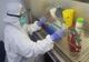 Două persoane vindecate de coronavirus, în Argeş!
