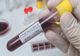 Comisarul șef al Poliţiei din Mioveni are coronavirus